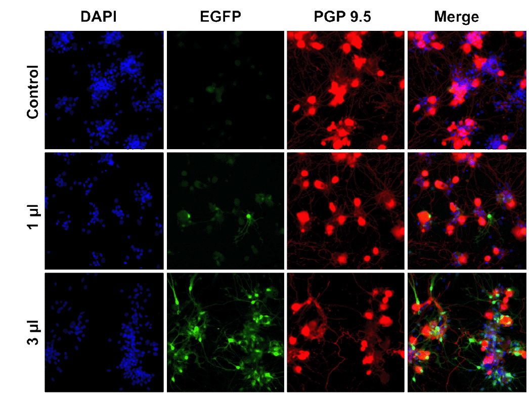 AdenoBlast transduction results