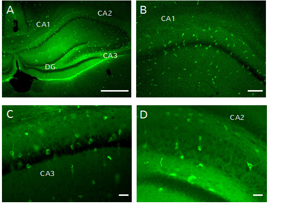 in vivo gene delivery