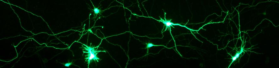 Transfection of Rat primary hippocampal neurons with NeuroMag 