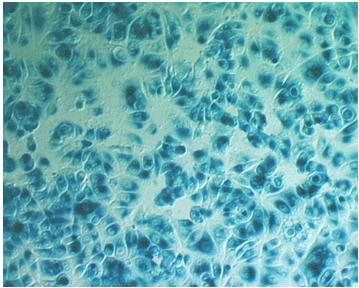 X-Gal expression in MCF-7 Cells with pVectOZ-LacZ plasmid