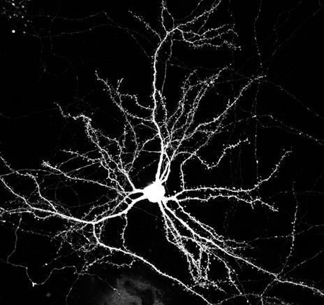 Mouse Cortical Neuron expressing GFP - Neuron Transfection